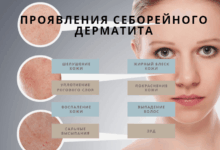 Photo of Эффективное лечение дерматита у домашнего питомца