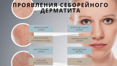 Photo of Эффективное лечение дерматита у домашнего питомца